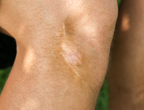 Scars: Proof That God Brought You Through
